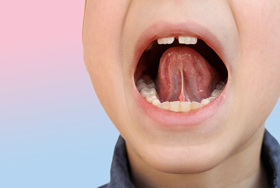 orofacial therapy